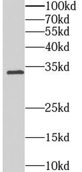 MGARP Rabbit Polyclonal Antibody