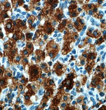 MGARP Rabbit Polyclonal Antibody