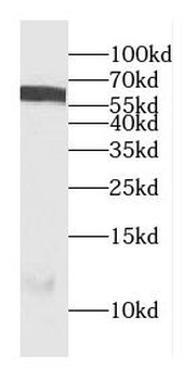 CEP85L Rabbit Polyclonal Antibody