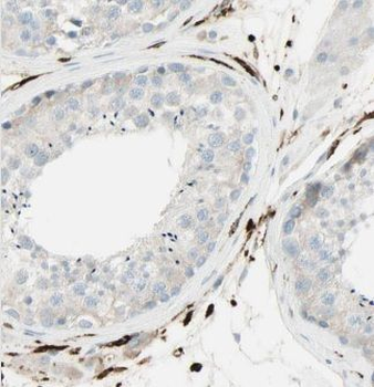 CEP85L Rabbit Polyclonal Antibody