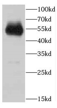 ARMT1 Rabbit Polyclonal Antibody