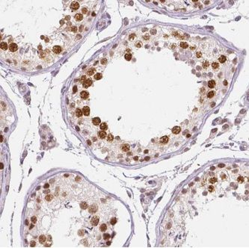 ARMT1 Rabbit Polyclonal Antibody