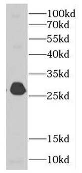 MALSU1 Rabbit Polyclonal Antibody