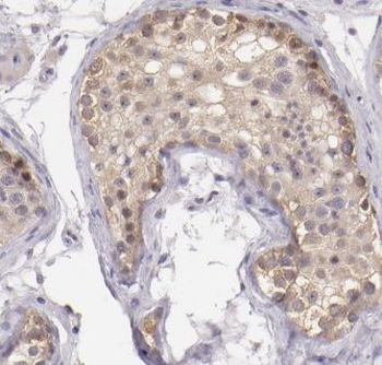 MALSU1 Rabbit Polyclonal Antibody