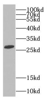 C9orf72 Antibody