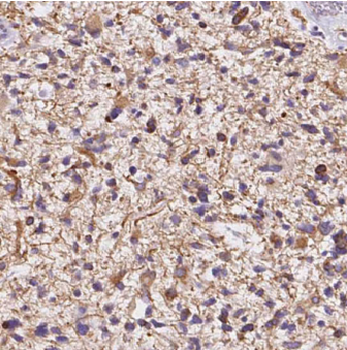 C9orf72 Antibody