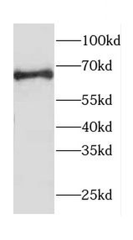 CACNB1 Rabbit Polyclonal Antibody