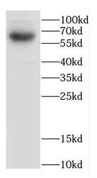 CACNB4 Rabbit Polyclonal Antibody