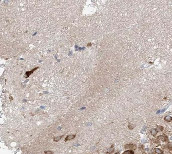 CACNG2 Rabbit Polyclonal Antibody