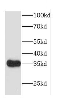 CACNG5 Rabbit Polyclonal Antibody