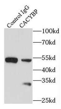 CACYBP Antibody