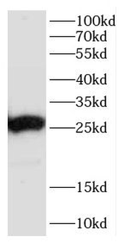 CACYBP Antibody