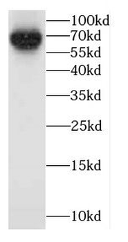 CADM4 Rabbit Polyclonal Antibody