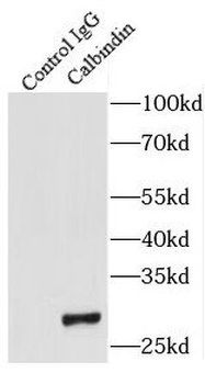 CALB1 Antibody