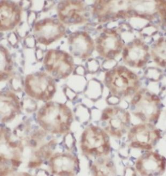 CALB1 Antibody