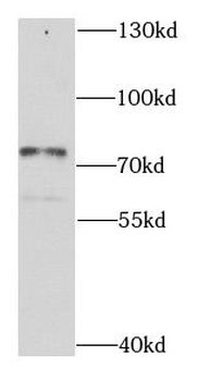 CALCOCO1 Rabbit Polyclonal Antibody