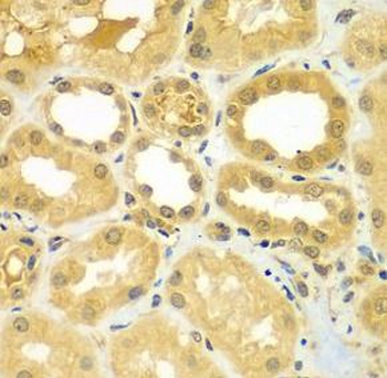 CALCOCO1 Rabbit Polyclonal Antibody