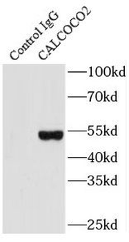 CALCOCO2 Rabbit Polyclonal Antibody