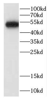 CALCOCO2 Rabbit Polyclonal Antibody