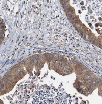CALCOCO2 Rabbit Polyclonal Antibody