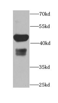 CAMK1D Rabbit Polyclonal Antibody