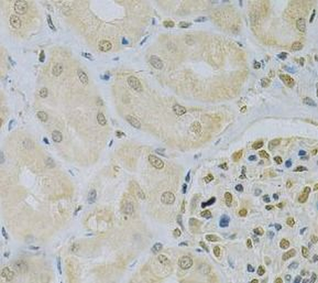 CAMK1D Rabbit Polyclonal Antibody