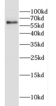 CAMKK1 Rabbit Polyclonal Antibody