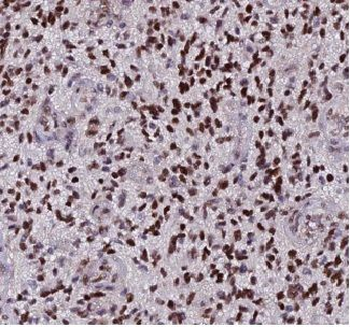 CAMKK1 Rabbit Polyclonal Antibody