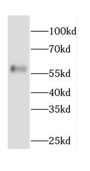 CAMKK2 Rabbit Polyclonal Antibody