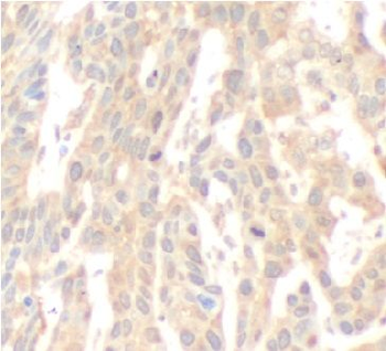 CAMKK2 Rabbit Polyclonal Antibody