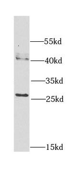 CAPNS1 Rabbit Polyclonal Antibody
