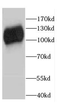CAPRIN1 Rabbit Polyclonal Antibody