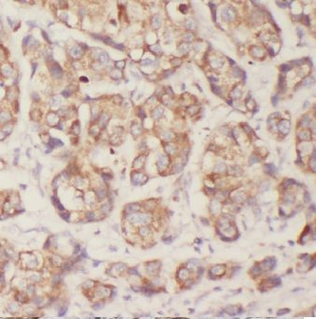 CAPRIN1 Rabbit Polyclonal Antibody