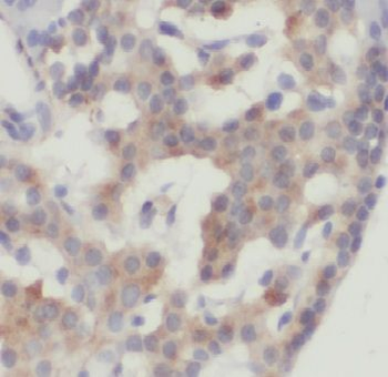 CADPS Rabbit Polyclonal Antibody