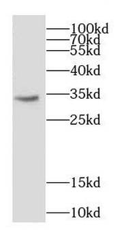 CAPZA1 Antibody