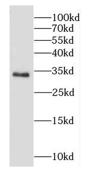 CAPZA1 Antibody