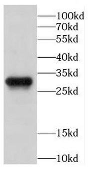 CAPZB Rabbit Polyclonal Antibody