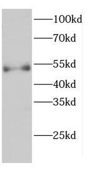 CARD9 Rabbit Polyclonal Antibody