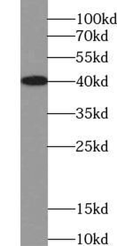 TNNT2 Rabbit Polyclonal Antibody