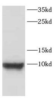 CARTPT Rabbit Polyclonal Antibody