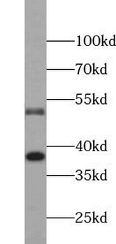 CASP8 Rabbit Polyclonal Antibody