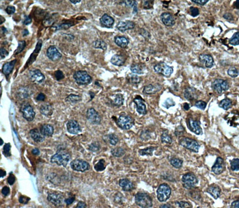 CASP8 Mouse Monoclonal Antibody