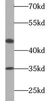 CASP9 Mouse Monoclonal Antibody