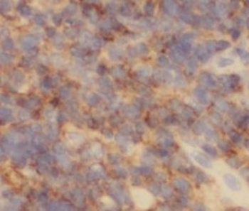 CASP9 Mouse Monoclonal Antibody