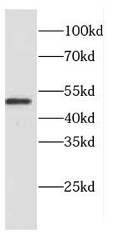 CTSD Rabbit Polyclonal Antibody