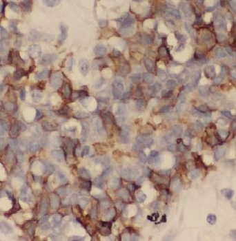 CTSD Rabbit Polyclonal Antibody