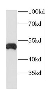 CTSD Rabbit Polyclonal Antibody