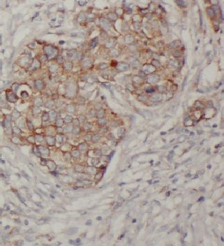 CTSD Rabbit Polyclonal Antibody