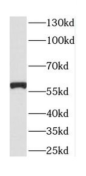 CTSF Rabbit Polyclonal Antibody
