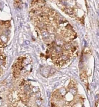 CTSF Rabbit Polyclonal Antibody